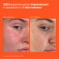SOS Stressed Skin Mini Starter Gift Set