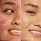 Swipe Serum Concealer®