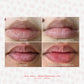LipSoftie® Lip Treatment