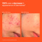 SOS Stressed Skin Mini Starter Gift Set