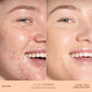 SunnyDays™ Tinted SPF 30